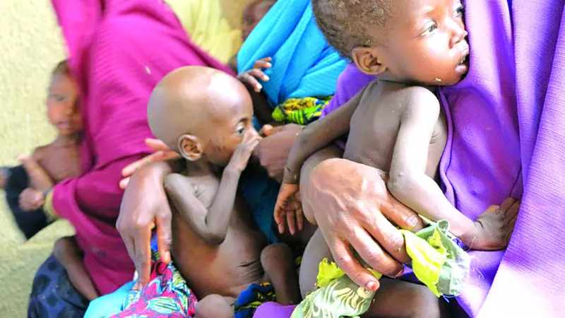 Northern Nigeria's Silent Crisis: 600,000 Children Face Severe Malnutrition as International Agencies Sound Alarm