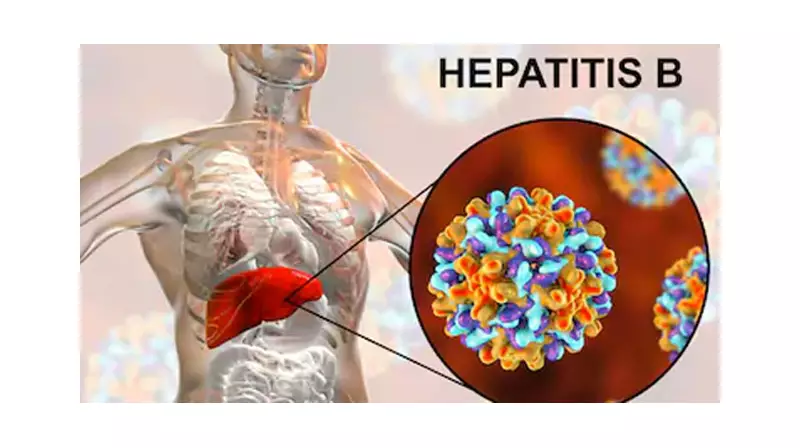 Nigeria Urged to Adopt Hepatitis B Birth Vaccination to Save Lives