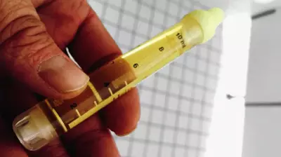 WHO Alarms Nigeria: Drug-Resistant Gonorrhea Spikes Globally