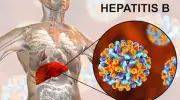 Nigeria Urged to Adopt Hepatitis B Birth Vaccination to Save Lives
