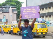 Pulmonary Hypertension: Nigeria's Silent Killer Disease - Why Early Detection Is Critical
