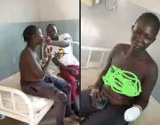 Woman's Hand Chopped Off by Suspected Herdsmen in Nasarawa