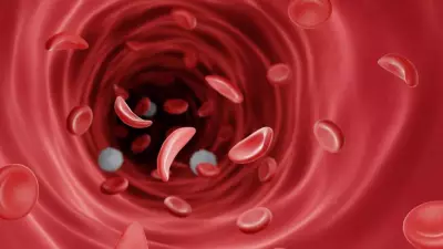 Nigeria's Sickle Cell Crisis: Experts Demand Policy Action, End Myths