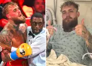 Jake Paul Undergoes Surgery After Broken Jaw in Anthony Joshua Knockout