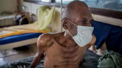 Nigeria's TB Fight Stalls: Funding Gaps Threaten 2025 WHO Targets