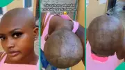 Nigerian Lady Alarmed by Mysterious Lines on Scalp After Shaving Head Bald