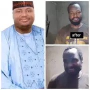 Zamfara Engineer Freed After 4 Months in Bandit Captivity: Before and After Photos Reveal Harsh Ordeal