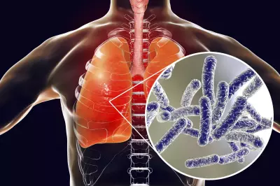 Legionnaires' Disease Outbreak Detected in Two London Areas, Health Probe Launched