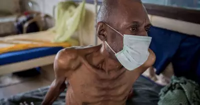 Six Diseases More Deadly Than HIV: WHO Data Reveals Global Health Shift