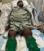 Haitian Asylum Seeker Dies in ICE Custody from Untreated Tooth Infection