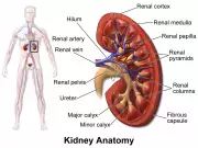 Medical Experts Advocate Regular Tests to Prevent Kidney Failure in Nigeria