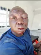 Suspected Car Hijacker Brutalized by Angry Mob in South Africa