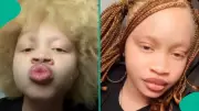 Albinism Lady's UTME 2026 Result Goes Viral After Exam