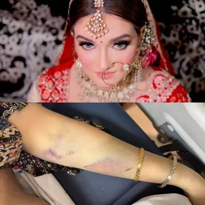 Beauty Queen Dies After Dowry Harassment; Father Alleges Murder