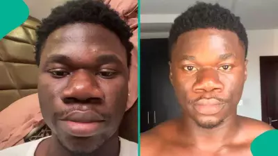 Nigerian Man Spends N18 Million on Nose Job, Shows Off New Look