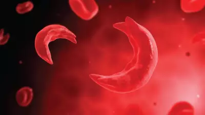 Sickle Cell NGO Honours Volunteers, Launches N10m Campaign in Lagos