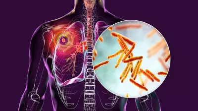 Tuberculosis: Stemming Spread, Curbing Stigma in Nigeria