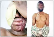 Acid Attack Suspect Admits He Mistook Victim, Was Paid N500,000