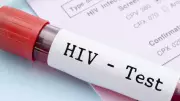 African Experts Urge Youth-Led HIV Prevention and Care Strategies