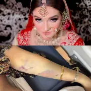 Beauty Queen Dies After Dowry Harassment; Father Alleges Murder