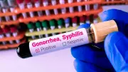 Gonorrhoea and Syphilis Reach Record Levels Across Europe
