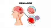 Meningitis Cases in Sokoto Surge Past 2,000 Mark, Health Officials Warn