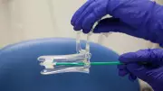 Nigeria Unveils Strategy to Eliminate Cervical Cancer by 2030