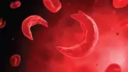 Sickle Cell NGO Honours Volunteers, Launches N10m Campaign in Lagos
