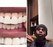 Yhemolee: Sparkling White Teeth Useless with Bad Breath