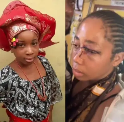 18-Year-Old Bride Brutalised by Husband Was Married Off Without Father's Consent