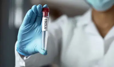 US CDC Warns Ebola Outbreak Could Reach 2014 West Africa Levels