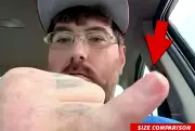Man with world's smallest penis launches fundraising for enlargement surgery