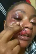 Nigerian Woman Recalls Painful Memories of Abusive Marriage