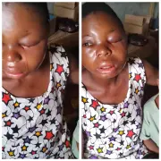 Pregnant Woman Brutally Assaulted by Husband in Anambra State