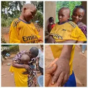 10-year-old abused boy discharged from Anambra hospital after recovery