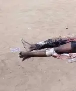 Jigawa mob burns alleged motorcycle thief after hospital escape