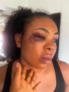Woman Details Horrific Ordeal of Sister Abducted by One-Chance Operators in Port Harcourt