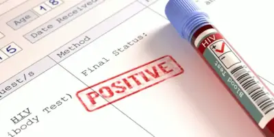 Harare HIV Crisis: Youth Account for Half of New Infections