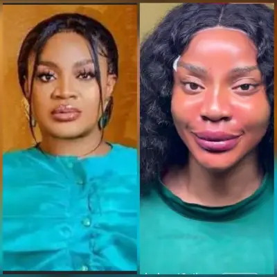 Uche Ogbodo Shows Off New Face After Cosmetic Procedure