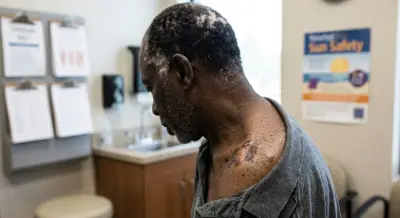 US Researchers Report Promising Results for Personalised Melanoma Vaccine