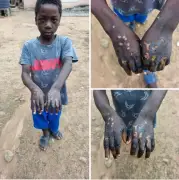 Benue Woman Accused of Torturing Underage Househelp with Hot Object