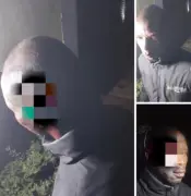 Nigerian Man Accuses Wife of Physical Assault, Shares Injury Photos