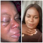 Nigerian Woman Shares Story of Surviving Domestic Violence on 18th Anniversary