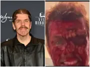 Perez Hilton Says 'I Need Help' from Hospital After TikTok Incident