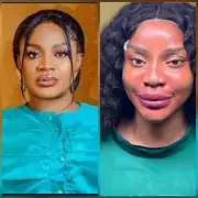 Uche Ogbodo Shows Off New Face After Cosmetic Procedure