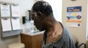 US Researchers Report Promising Results for Personalised Melanoma Vaccine