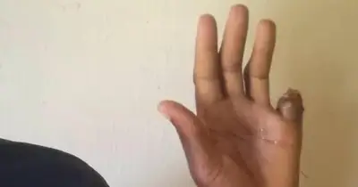 Man cuts off own finger over ₦80m occult deal, reports buyer