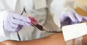 Jehovah's Witnesses Now Let Members Decide on Blood Transfusions