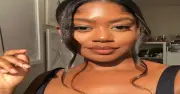 Relaxer Risks: What Science Says Before You Chemically Straighten Hair