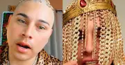 Dan Sur: Rapper Who Traded Natural Hair for Gold Chain Implants